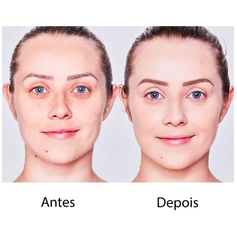 Protetor Solar Facial Pink Stick FPS 90 Pink Cheeks 14g - Imagem 4